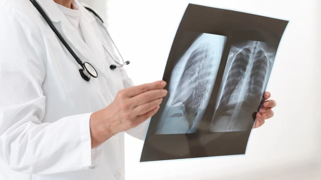 Bệnh viện Phổi Nghệ An: Thông tin cần thiết trước khi thăm khám