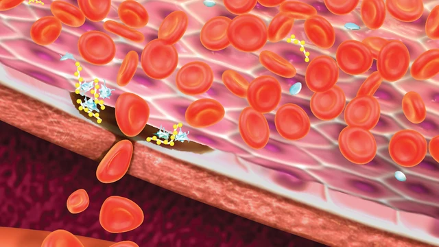 benh/benh-von-willebrand.html