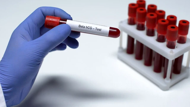 bai-viet/y-nghia-chi-so-beta-ngay-10-sau-chuyen-phoi.html