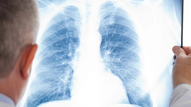 bai-viet/bi-benh-lao-phoi-co-chua-duoc-khong.html