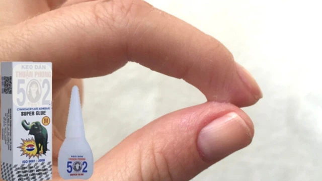 bai-viet/bi-keo-502-dinh-vao-tay-6-cach-xu-ly-nhanh-khong-dau-tai-nha.html