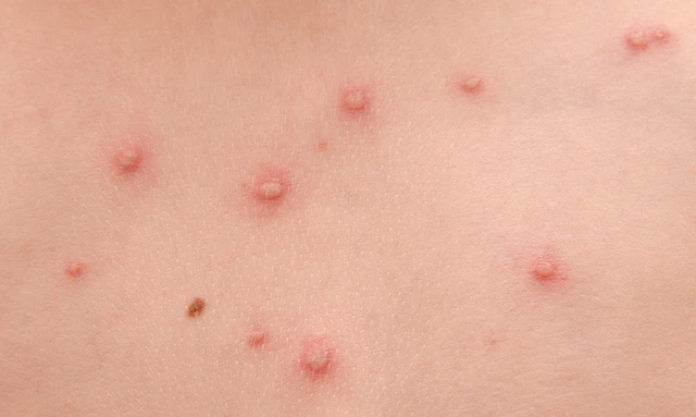 bai-viet/bi-kien-can-sung-mu-co-nguy-hiem-khong-46605.html