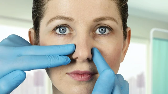 bai-viet/bi-lech-vach-ngan-mui-co-nen-mo-khong.html