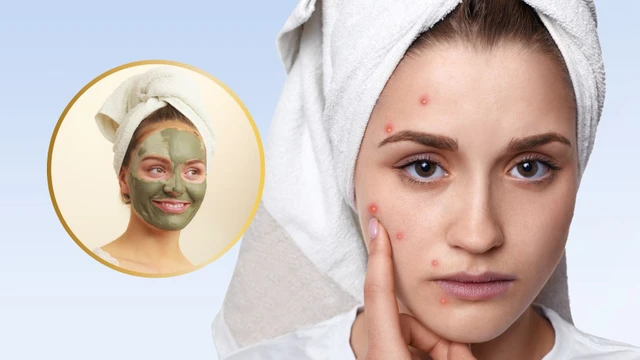 bai-viet/bi-mun-viem-co-nen-dap-mat-na-dat-set-khong.html