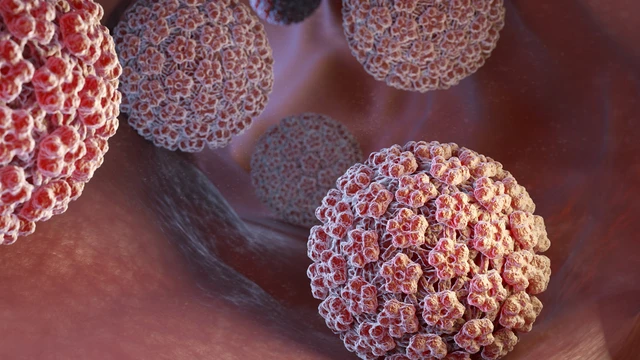 bai-viet/bi-nhiem-hpv-18-phai-lam-sao-cac-benh-ly-do-virus-hpv-18-gay-ra.html