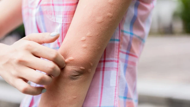 bai-viet/giai-dap-thac-mac-bi-me-day-bao-lau-thi-khoi-54553.html