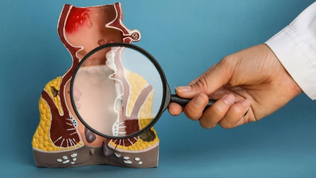 bai-viet/bi-nut-ke-hau-mon-uong-thuoc-gi.html