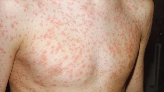 bai-viet/bi-phat-ban-co-nam-may-lanh-duoc-khong.html