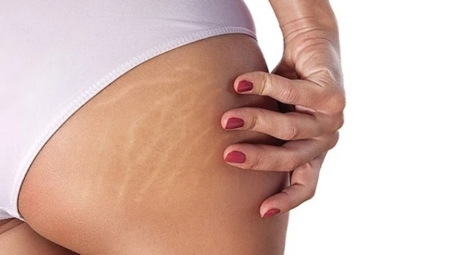 bai-viet/bi-ran-da-mong-mau-trang-chua-the-nao-56577.html