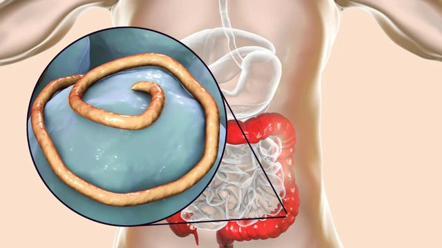 bai-viet/bi-tai-nhiem-giun-kim-phai-lam-sao-vi-sao-uong-thuoc-tay-giun-van-con-giun-kim.html