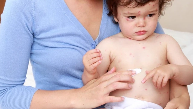 bai-viet/bi-thuy-dau-roi-co-bi-lai-khong-cach-dieu-tri-benh-thuy-dau.html