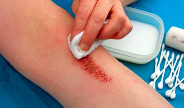 bai-viet/bi-tray-xuoc-da-nen-boi-gi-de-khong-de-lai-seo-57876.html