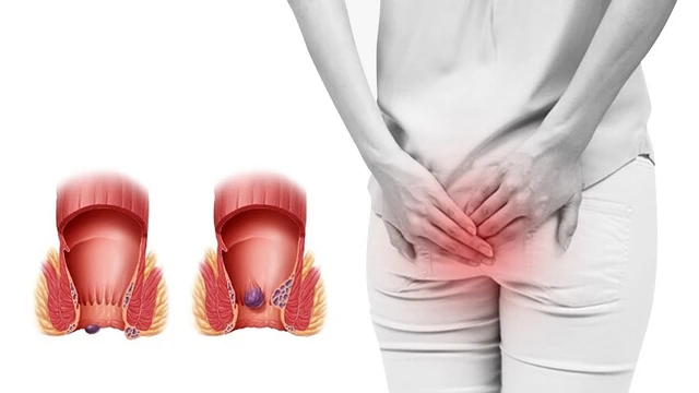 bai-viet/bi-tri-uong-thuoc-co-het-khong-phan-loai-va-cap-do-benh-tri.html