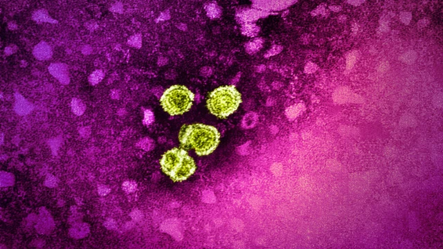 bai-viet/bi-viem-gan-b-song-duoc-bao-lau-neu-phat-hien-va-dieu-tri-som.html