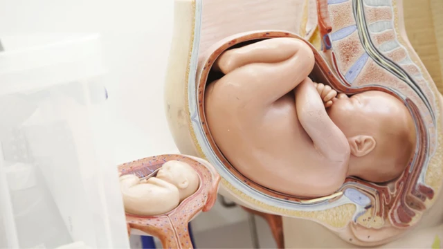 bai-viet/bieu-do-chuyen-da-la-gi-nhung-yeu-to-trong-bieu-do-chuyen-da.html