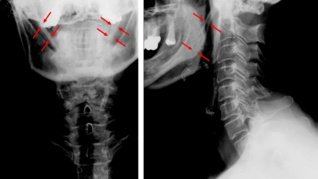 bai-viet/dai-mom-tram-trieu-chung-nguyen-nhan-phuong-phap-chan-doan-va-dieu-tri.html