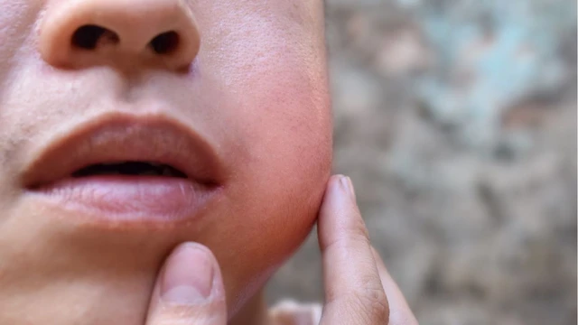 bai-viet/bieu-hien-quai-bi-la-gi-cach-phong-va-tri-benh-ra-sao.html