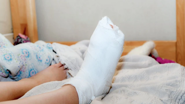 bai-viet/bo-bot-chan-va-nhung-luu-y-quan-trong-trong-dieu-tri-gay-xuong.html