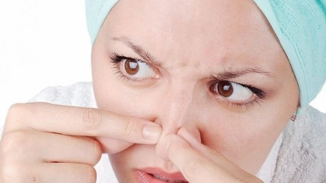 bai-viet/bo-tui-ngay-04-cach-tri-mun-cam-o-mui-cuc-hieu-qua-67009.html