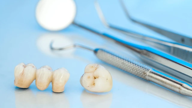 bai-viet/boc-rang-ham-bi-sau-gia-bao-nhieu-quy-trinh-thuc-hien.html