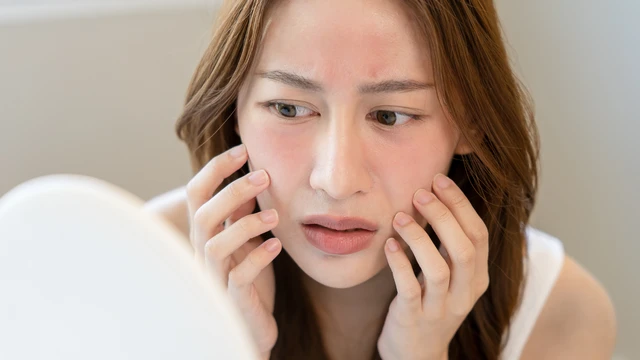 bai-viet/boi-kem-duong-am-bi-nong-mat-co-sao-khong-nguyen-nhan-va-cach-xu-ly-hieu-qua.html