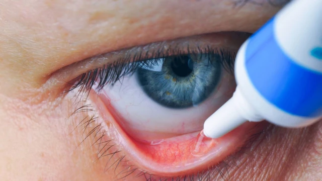 bai-viet/boi-thuoc-mo-tra-mat-vao-vung-kin-co-duoc-khong.html