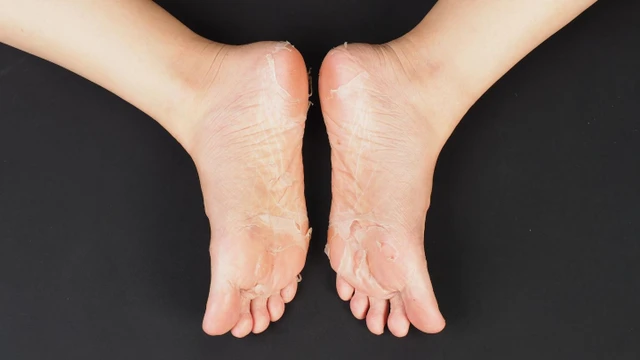 bai-viet/tinh-trang-bong-da-chan-nguyen-nhan-va-cach-khac-phuc.html