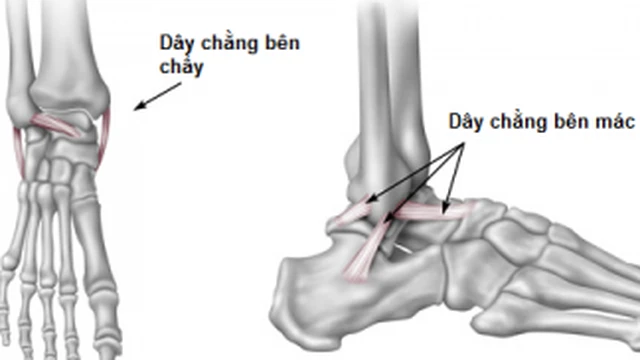 bai-viet/bong-gan-man-tinh-la-gi-bieu-hien-co-anh-huong-nghiem-trong-khong-52312.html