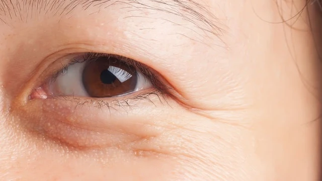 bai-viet/bong-mat-chay-xe-phai-lam-sao-61476.html