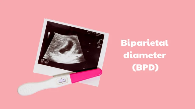 bai-viet/bpd-trong-sieu-am-thai-la-gi-khi-nao-thuc-hien-do-chi-so-bpd.html