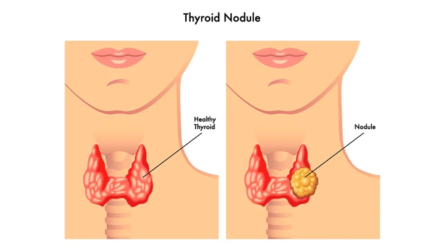 benh/buou-giap-nhan-1.html