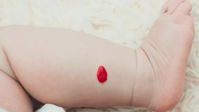 bai-viet/tat-ca-nhung-thong-tin-ban-can-biet-ve-buou-mau-duoi-da.html