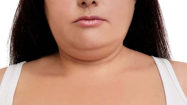 bai-viet/cac-bai-tap-giam-mo-mat-hieu-qua-va-nhung-luu-y-quan-trong-can-biet.html