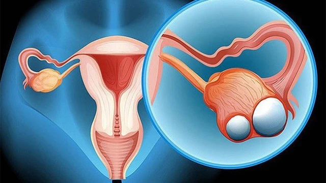 bai-viet/cac-giai-doan-cua-u-te-bao-mam-o-tre-em-62041.html