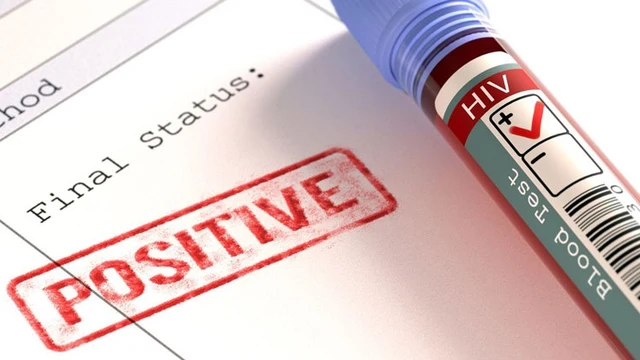 bai-viet/tai-sao-nhieu-nguoi-khong-biet-minh-bi-nhiem-hiv-dau-hieu-nhan-biet.html