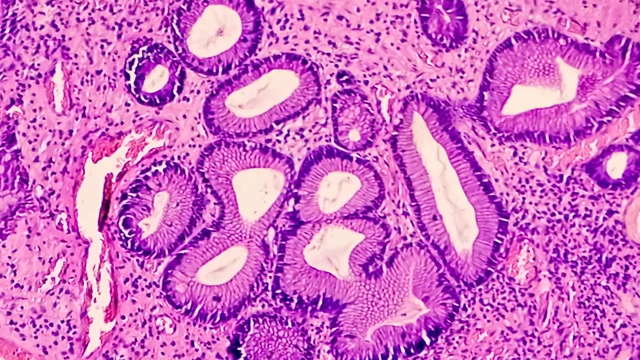 bai-viet/cac-loai-polyp-da-day-dau-hieu-nhan-biet-va-muc-do-nguy-hiem.html