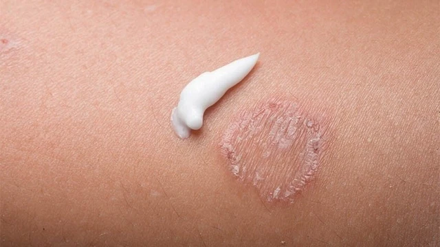 bai-viet/tham-khao-cac-loai-thuoc-tri-lac-dong-tien-hieu-qua.html