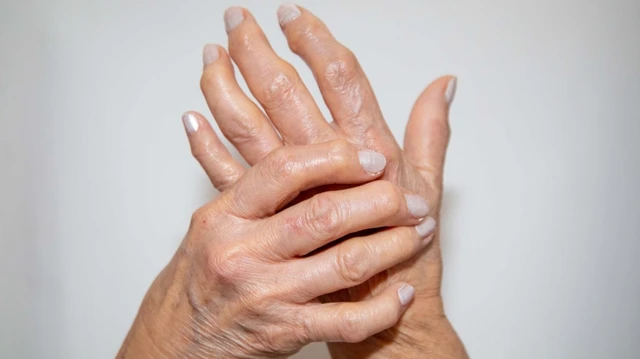 bai-viet/cac-loai-viem-khop-dang-thap-thuong-gap.html