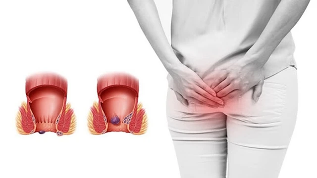 bai-viet/cac-phuong-phap-dieu-tri-benh-tri-moi-nhat-hien-nay.html