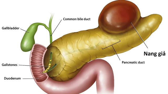 bai-viet/cac-phuong-phap-dieu-tri-nang-gia-tuy-pho-bien-hien-nay.html