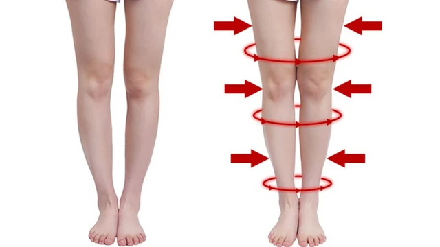 bai-viet/cac-phuong-phap-nan-chan-vong-kieng-hieu-qua-63758.html