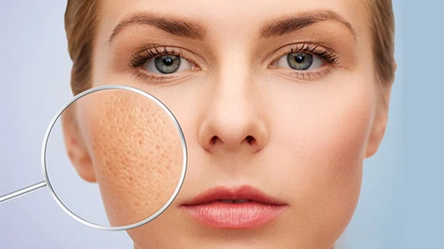 bai-viet/lo-chan-long-mat-to-nguyen-nhan-va-cach-cai-thien-tinh-trang-nay.html