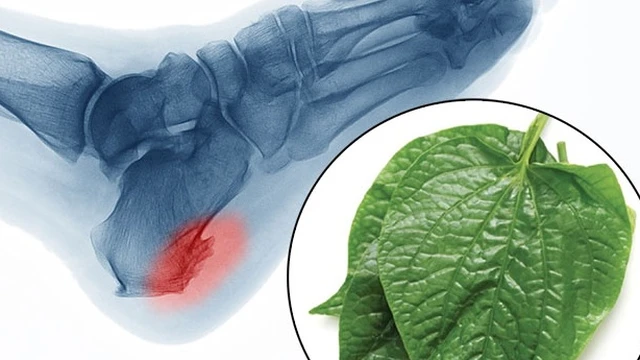 bai-viet/cach-chua-gai-got-chan-bang-la-lot-dung-cach-71952.html