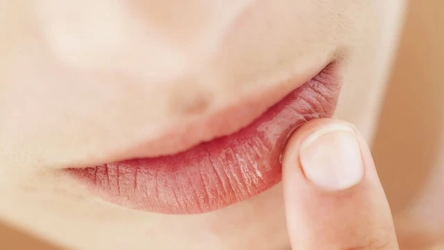 bai-viet/cach-chua-rop-moi-nhanh-nhat-tai-nha-voi-nguyen-lieu-tu-nhien-60478.html