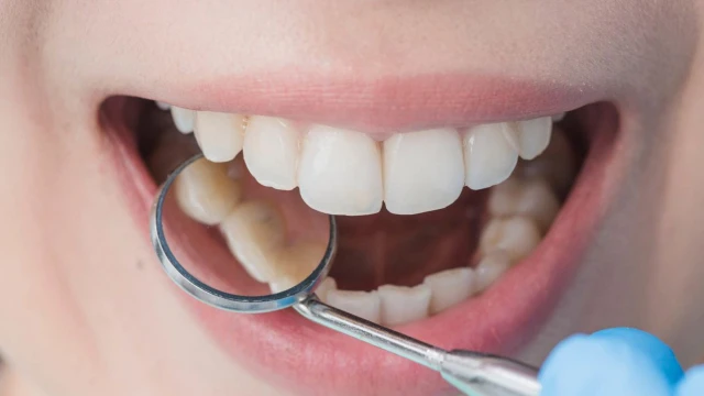 bai-viet/cach-dieu-tri-ung-thu-nuou-rang-57342.html