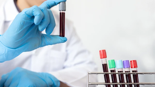 bai-viet/cach-doc-ket-qua-xet-nghiem-nipt-dung-cach-me-bau-can-biet.html