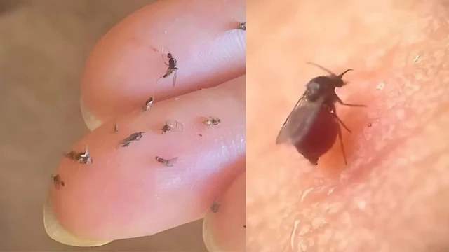 bai-viet/cach-duoi-din-bo-mat-ma-ban-nen-biet.html