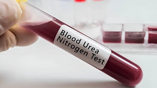 bai-viet/cach-giam-ure-trong-mau-hieu-qua-bao-ve-suc-khoe-nguoi-benh.html