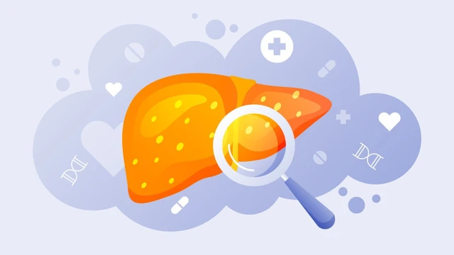 bai-viet/hieu-ve-muc-men-gan-cao-1500-nguyen-nhan-va-bien-phap-dieu-tri.html