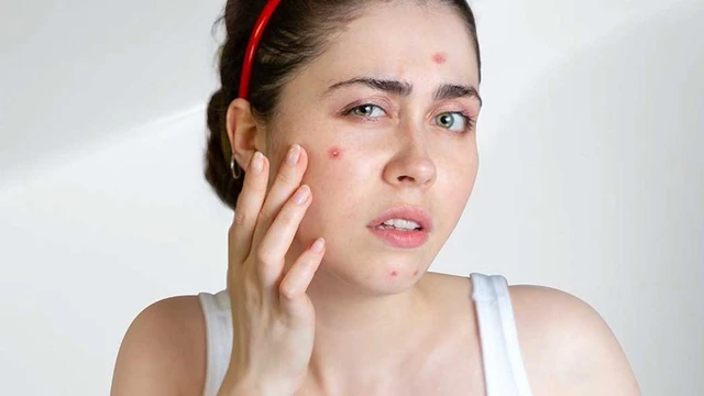 bai-viet/cach-lam-mun-boc-nhanh-chin-don-gian-hieu-qua-va-lanh-tinh-71774.html